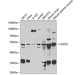 Western Blot - Anti-CSN2 Antibody (A15502) - Antibodies.com