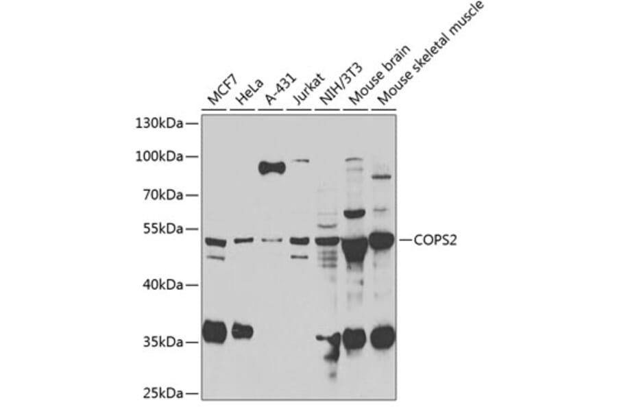 Western Blot - Anti-CSN2 Antibody (A15502) - Antibodies.com