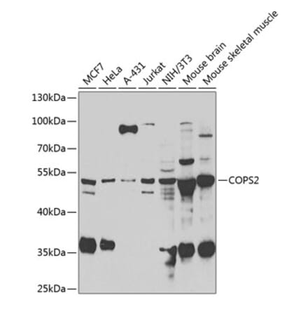 Western Blot - Anti-CSN2 Antibody (A15502) - Antibodies.com