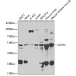 Western Blot - Anti-CSN2 Antibody (A15502) - Antibodies.com