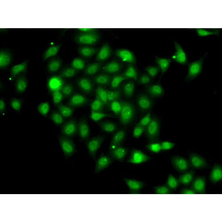 Immunofluorescence - Anti-CSN2 Antibody (A15502) - Antibodies.com