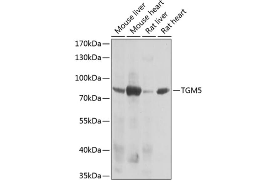 Western Blot - Anti-Transglutaminase 5/TGM5 Antibody (A15503) - Antibodies.com
