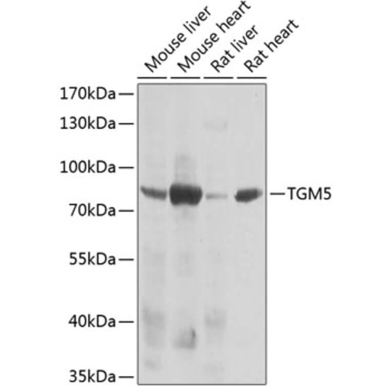 Western Blot - Anti-Transglutaminase 5/TGM5 Antibody (A15503) - Antibodies.com