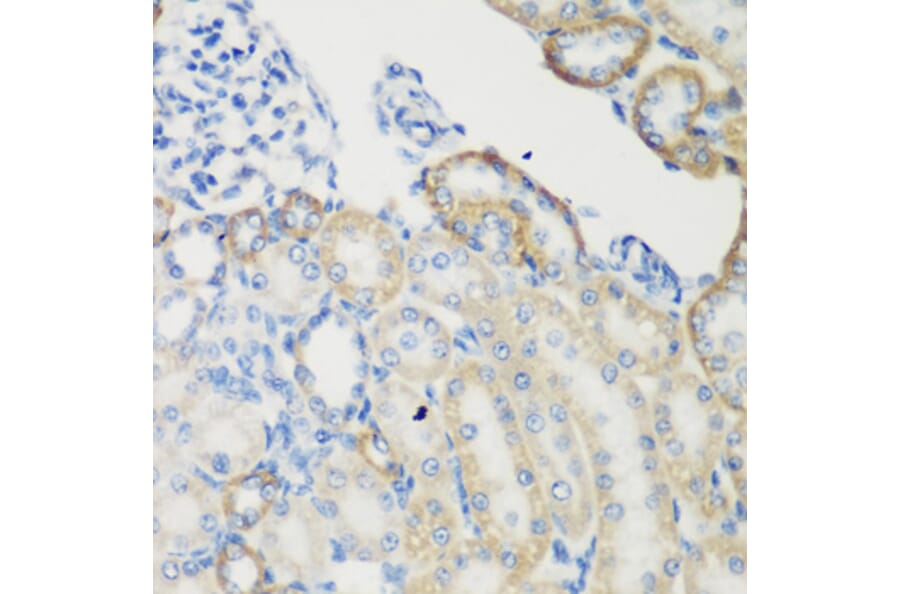 Immunohistochemistry - Anti-Transglutaminase 5/TGM5 Antibody (A15503) - Antibodies.com
