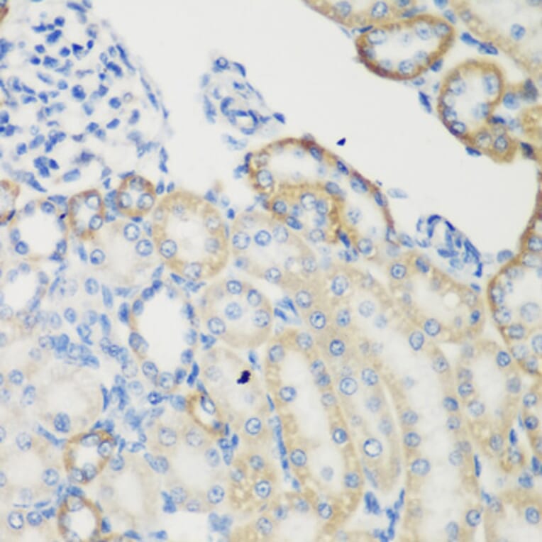 Immunohistochemistry - Anti-Transglutaminase 5/TGM5 Antibody (A15503) - Antibodies.com
