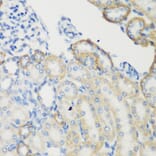 Immunohistochemistry - Anti-Transglutaminase 5/TGM5 Antibody (A15503) - Antibodies.com