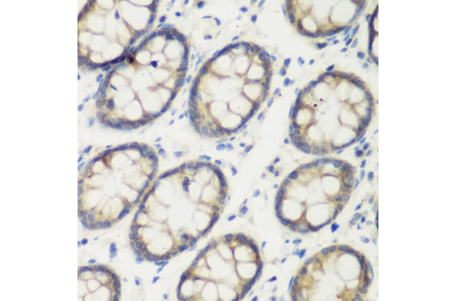 Immunohistochemistry - Anti-Transglutaminase 5/TGM5 Antibody (A15503) - Antibodies.com