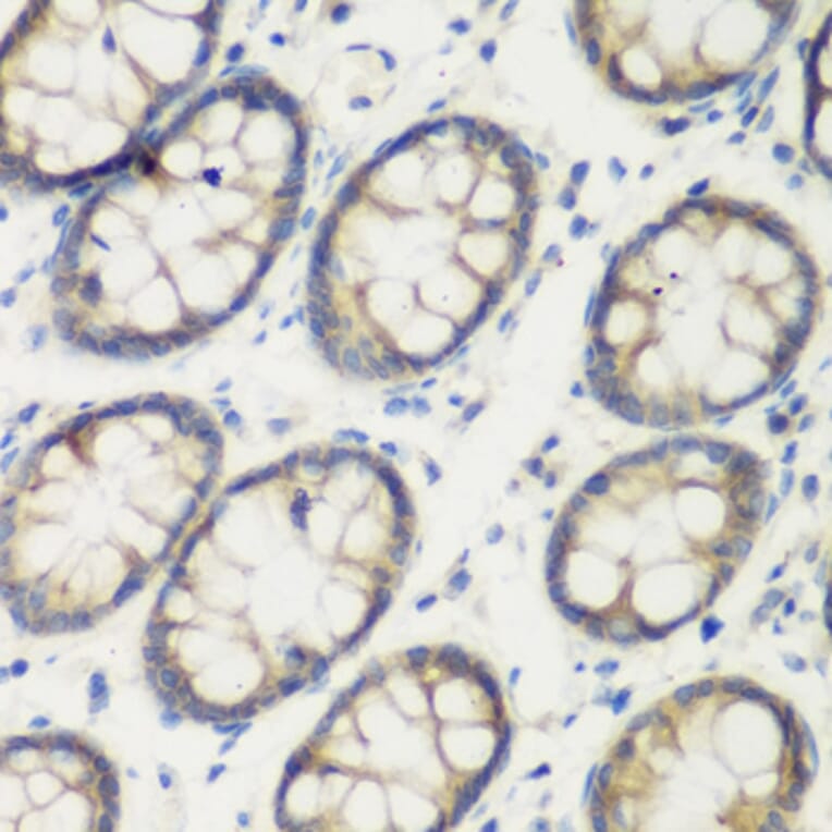 Immunohistochemistry - Anti-Transglutaminase 5/TGM5 Antibody (A15503) - Antibodies.com