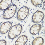 Immunohistochemistry - Anti-Transglutaminase 5/TGM5 Antibody (A15503) - Antibodies.com