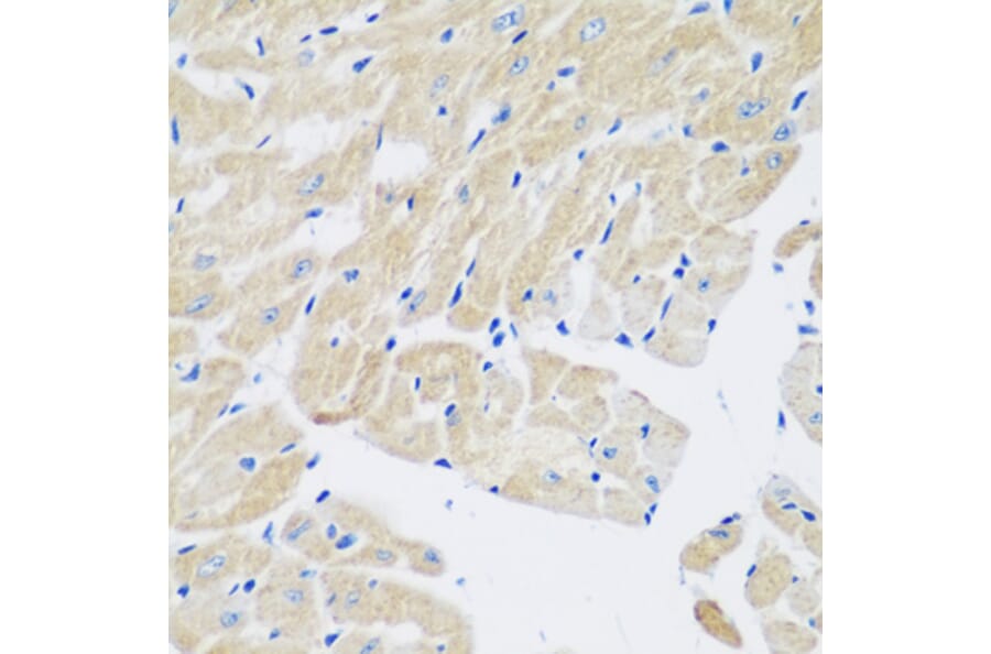 Immunohistochemistry - Anti-Transglutaminase 5/TGM5 Antibody (A15503) - Antibodies.com