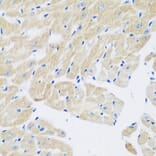 Immunohistochemistry - Anti-Transglutaminase 5/TGM5 Antibody (A15503) - Antibodies.com