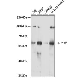 Western Blot - Anti-NMT2 Antibody (A15504) - Antibodies.com