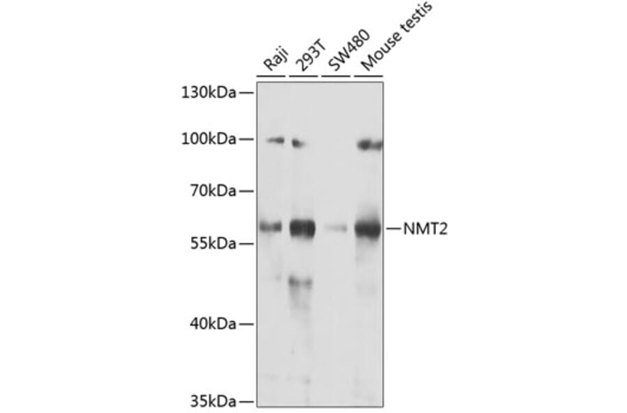 Western Blot - Anti-NMT2 Antibody (A15504) - Antibodies.com
