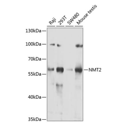 Western Blot - Anti-NMT2 Antibody (A15504) - Antibodies.com