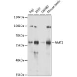 Western Blot - Anti-NMT2 Antibody (A15504) - Antibodies.com
