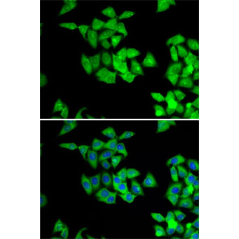 Immunofluorescence - Anti-NMT2 Antibody (A15504) - Antibodies.com