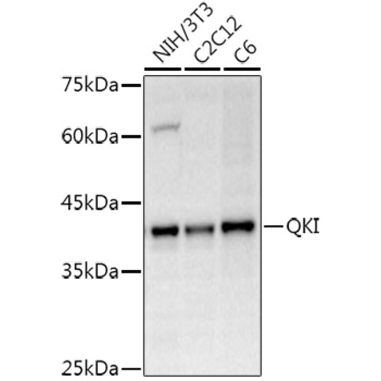 Western Blot - Anti-QKI Antibody (A15505) - Antibodies.com