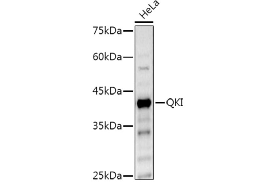 Western Blot - Anti-QKI Antibody (A15505) - Antibodies.com