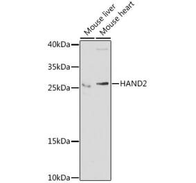 Western Blot - Anti-HAND2 Antibody (A15506) - Antibodies.com