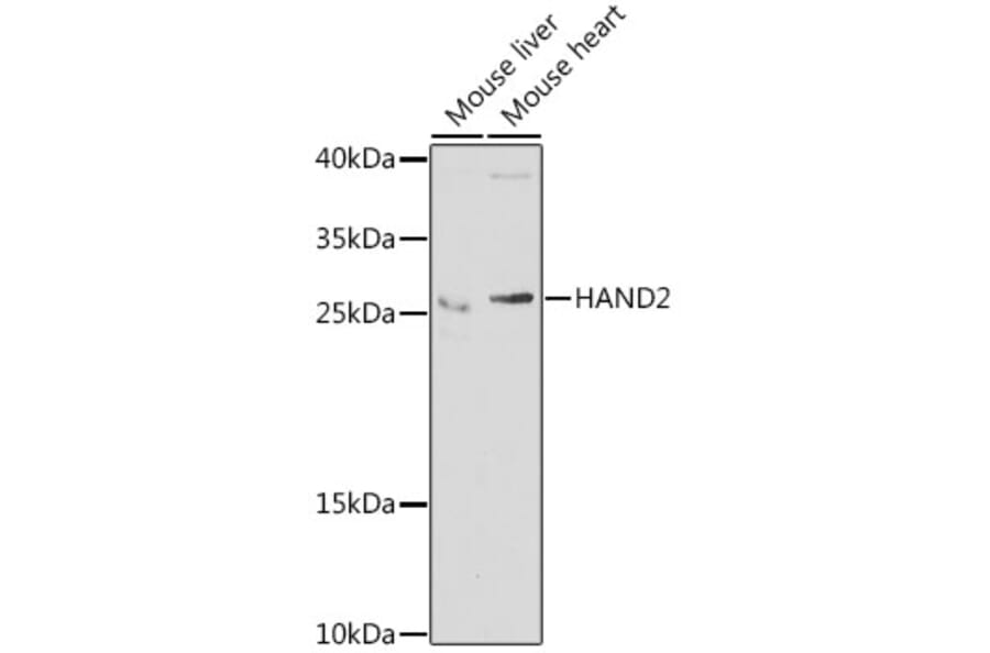 Western Blot - Anti-HAND2 Antibody (A15506) - Antibodies.com