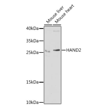 Western Blot - Anti-HAND2 Antibody (A15506) - Antibodies.com