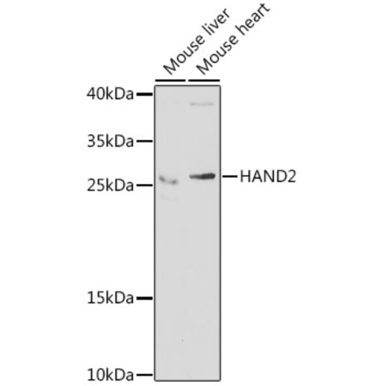 Western Blot - Anti-HAND2 Antibody (A15506) - Antibodies.com