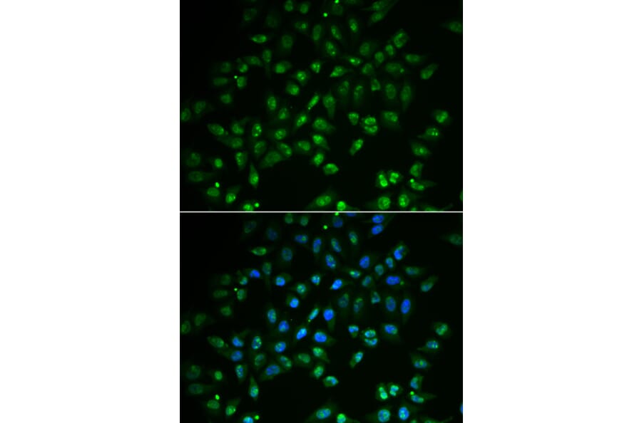 Immunofluorescence - Anti-HAND2 Antibody (A15506) - Antibodies.com