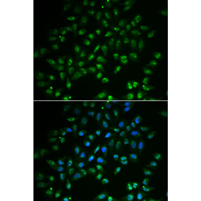 Immunofluorescence - Anti-HAND2 Antibody (A15506) - Antibodies.com