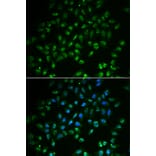 Immunofluorescence - Anti-HAND2 Antibody (A15506) - Antibodies.com