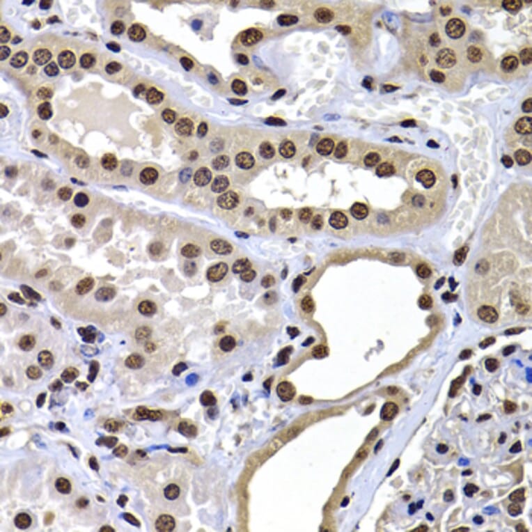 Immunohistochemistry - Anti-mH2A1 Antibody (A15507) - Antibodies.com