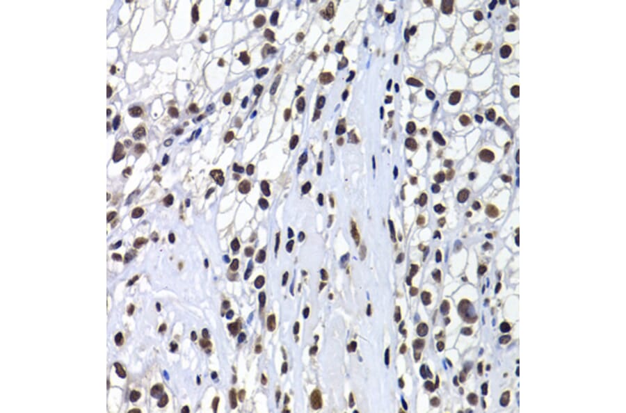 Immunohistochemistry - Anti-mH2A1 Antibody (A15507) - Antibodies.com
