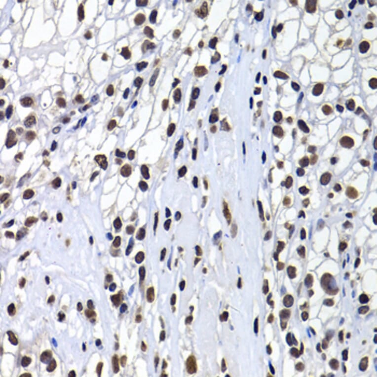 Immunohistochemistry - Anti-mH2A1 Antibody (A15507) - Antibodies.com