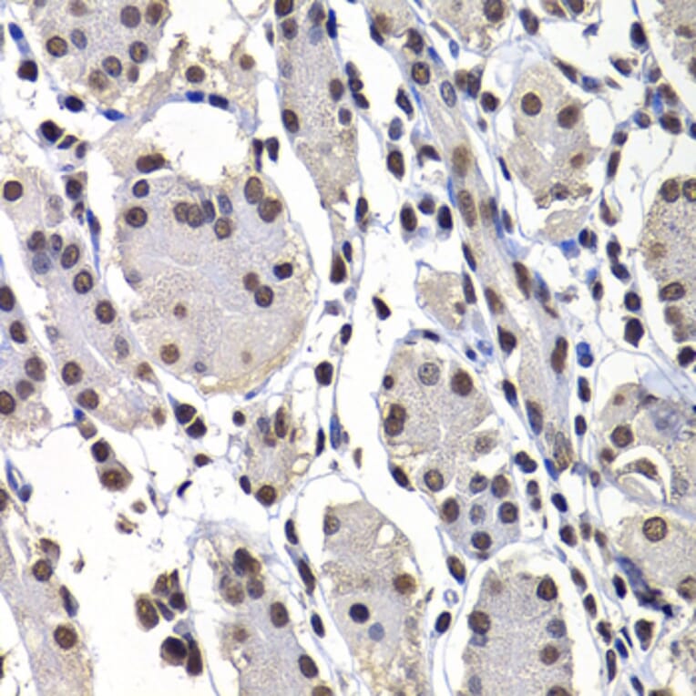 Immunohistochemistry - Anti-mH2A1 Antibody (A15507) - Antibodies.com