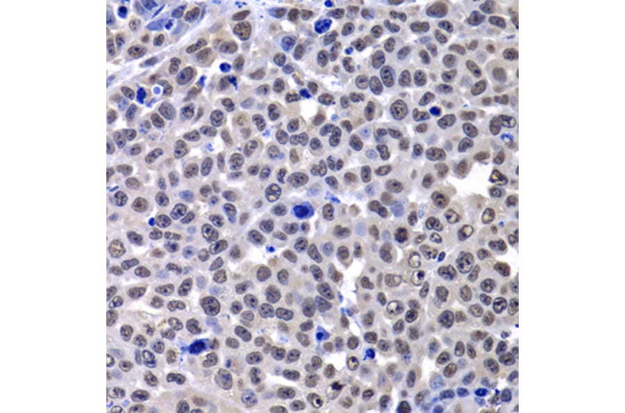 Immunohistochemistry - Anti-mH2A1 Antibody (A15507) - Antibodies.com