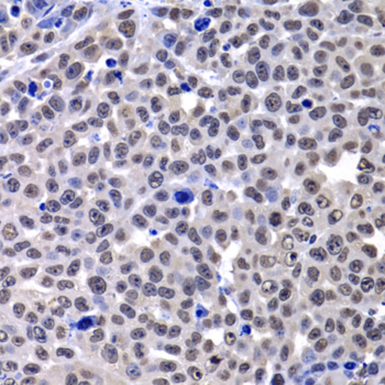 Immunohistochemistry - Anti-mH2A1 Antibody (A15507) - Antibodies.com
