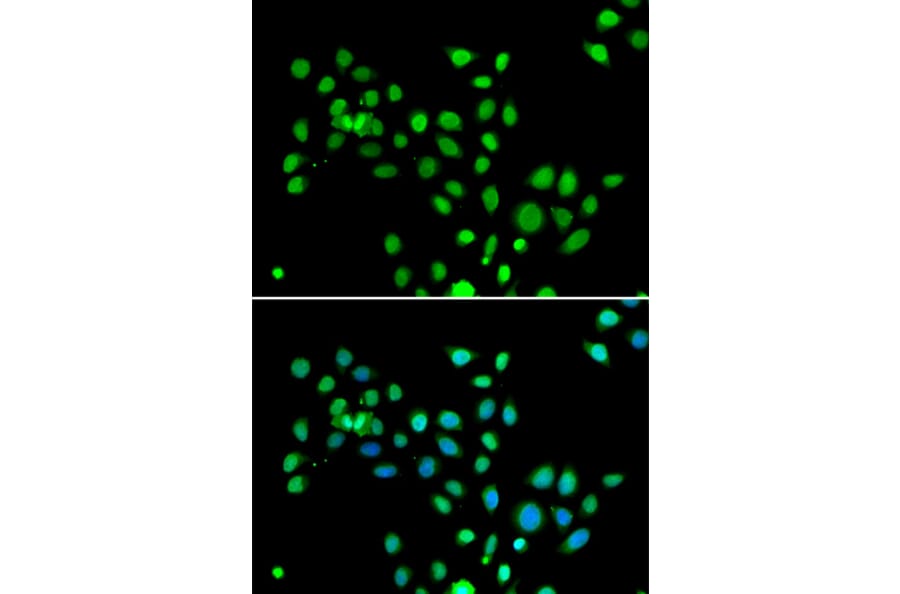 Immunofluorescence - Anti-mH2A1 Antibody (A15507) - Antibodies.com