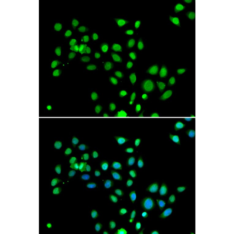 Immunofluorescence - Anti-mH2A1 Antibody (A15507) - Antibodies.com