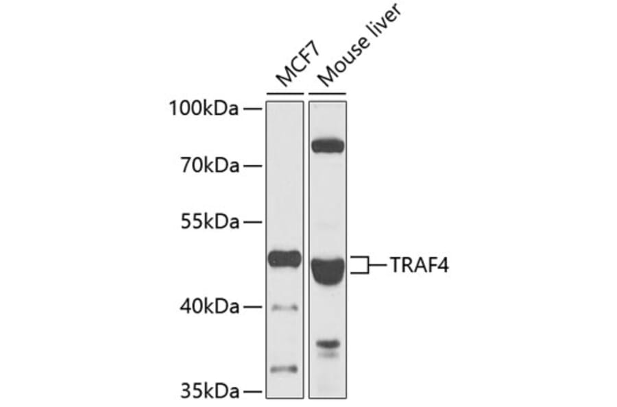 Western Blot - Anti-TRAF4 Antibody (A15508) - Antibodies.com
