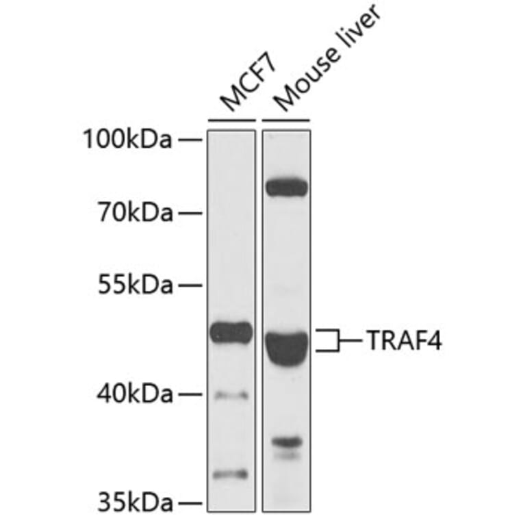 Western Blot - Anti-TRAF4 Antibody (A15508) - Antibodies.com