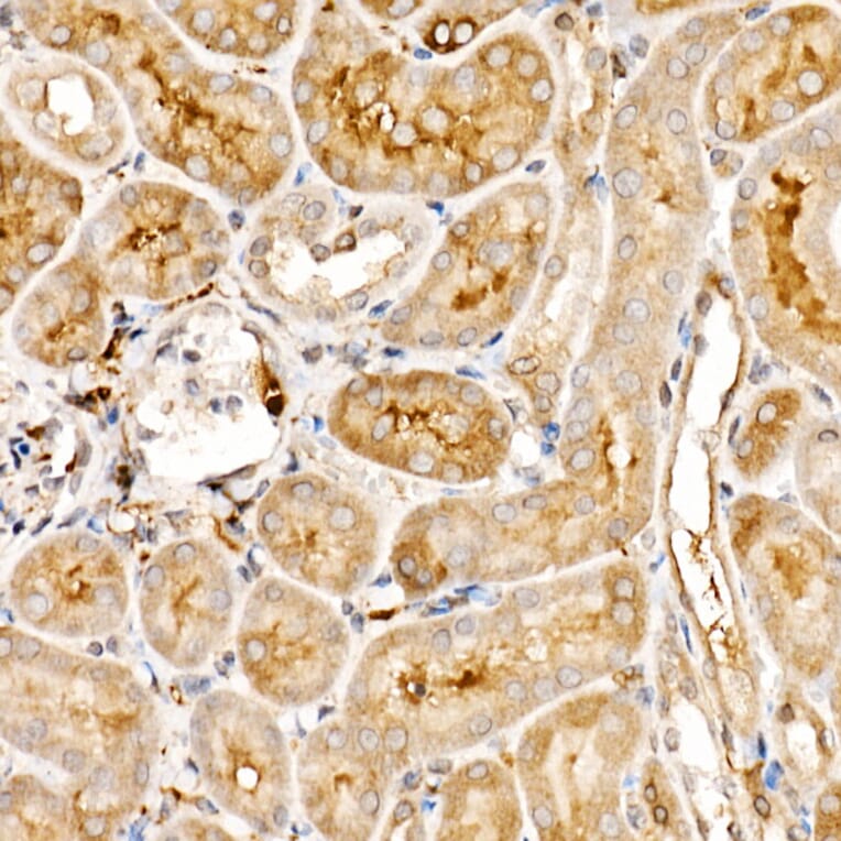 Immunohistochemistry - Anti-TRAF4 Antibody (A15508) - Antibodies.com