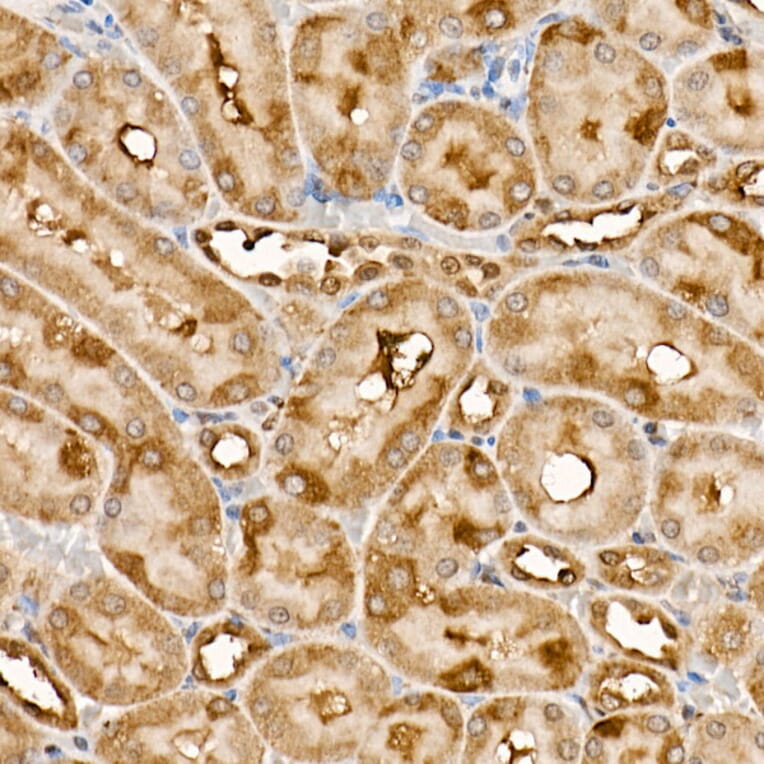 Immunohistochemistry - Anti-TRAF4 Antibody (A15508) - Antibodies.com