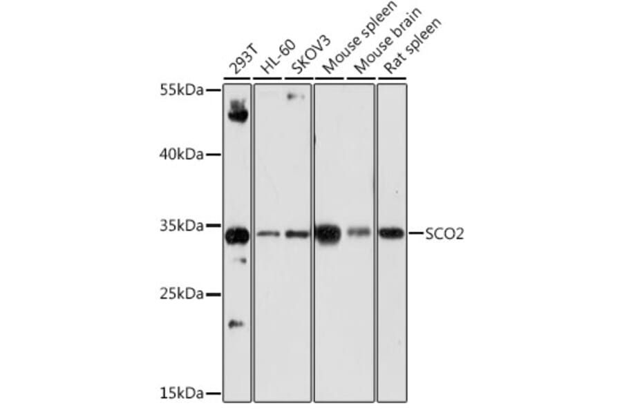 Western Blot - Anti-SCO2 Antibody (A15509) - Antibodies.com