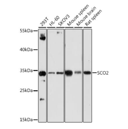 Western Blot - Anti-SCO2 Antibody (A15509) - Antibodies.com