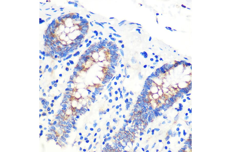 Immunohistochemistry - Anti-SCO2 Antibody (A15509) - Antibodies.com