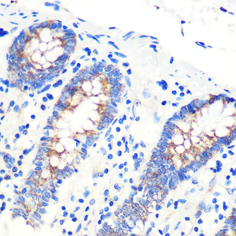 Immunohistochemistry - Anti-SCO2 Antibody (A15509) - Antibodies.com