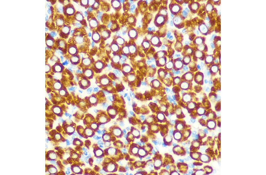 Immunohistochemistry - Anti-SCO2 Antibody (A15509) - Antibodies.com