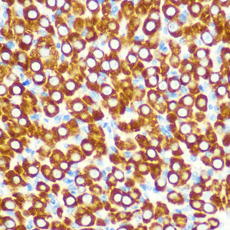 Immunohistochemistry - Anti-SCO2 Antibody (A15509) - Antibodies.com