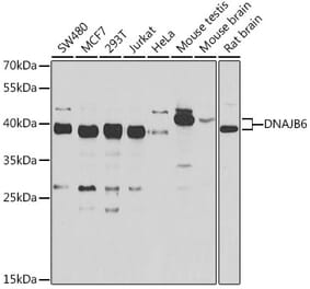 Western Blot - Anti-DNAJB6 Antibody (A15510) - Antibodies.com