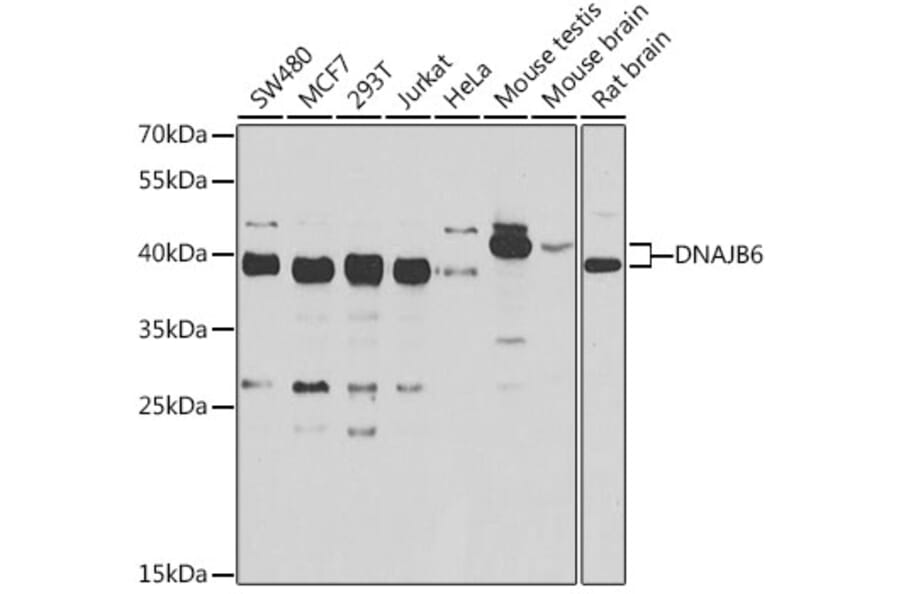 Western Blot - Anti-DNAJB6 Antibody (A15510) - Antibodies.com
