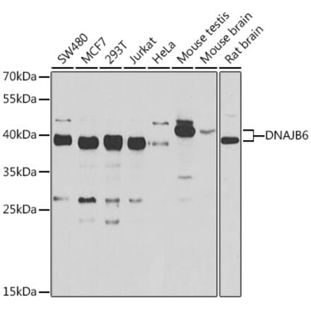 Western Blot - Anti-DNAJB6 Antibody (A15510) - Antibodies.com